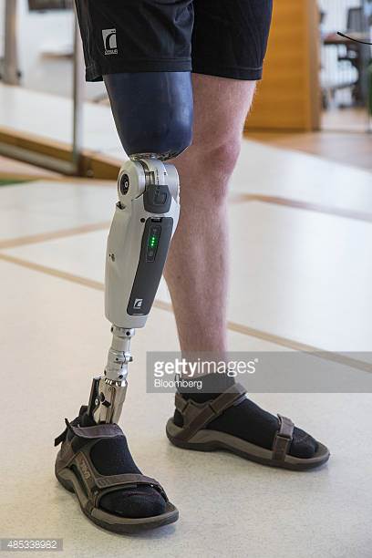 Knee Disarticulation Prosthesis – Medical Care Alliance