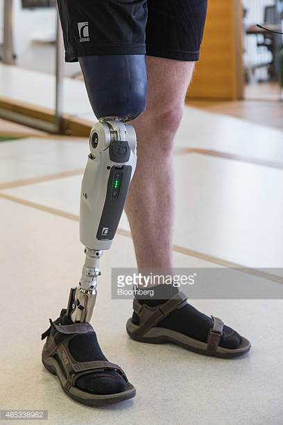 Knee Disarticulation Prosthesis Medical Care Alliance